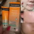 Neutrogena Anti-Acne Oil-Free Facial Moisturizer 50 ml