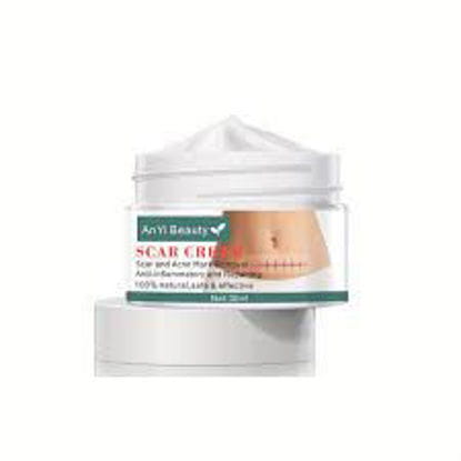 AnYi Scar Cream,Scar Away Cream Scar Removal Cream , 30ml